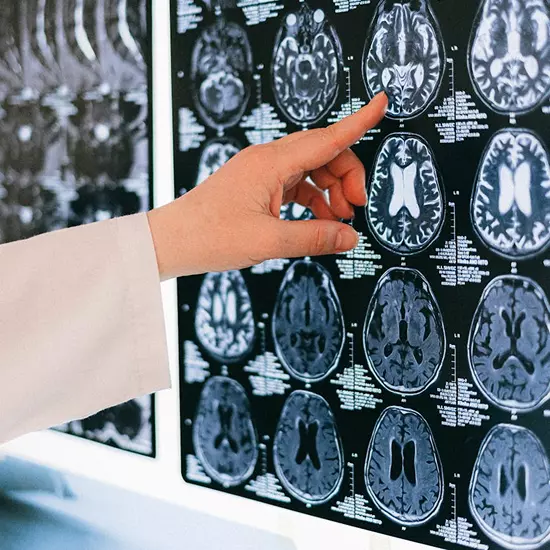 Neurologist examining a brain scan report